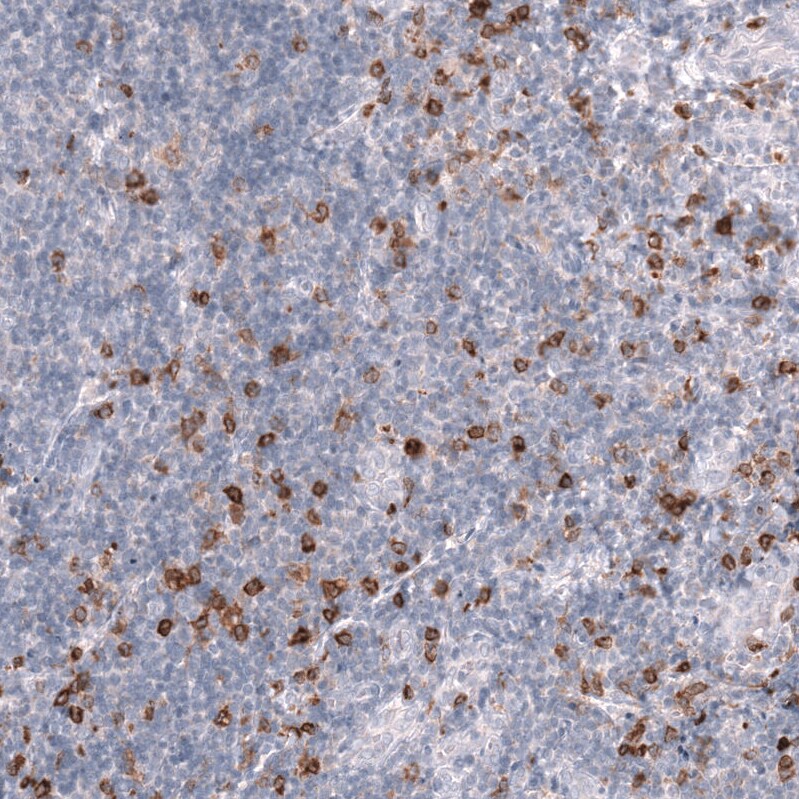 CLEC10A/CD301 Antibody (CL15513) - Azide and BSA Free Immunohistochemistry-Paraffin: CLEC10A/CD301 Antibody [NBP3-44333]