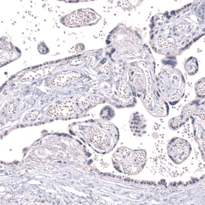 CLEC10A/CD301 Antibody (CL15513) - Azide and BSA Free Immunohistochemistry-Paraffin: CLEC10A/CD301 Antibody [NBP3-44333]