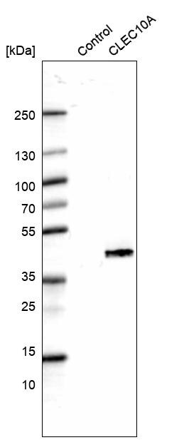 CLEC10A/CD301 Antibody (CL15523) - Azide and BSA Free Western Blot: CLEC10A/CD301 Antibody [NBP3-44334]