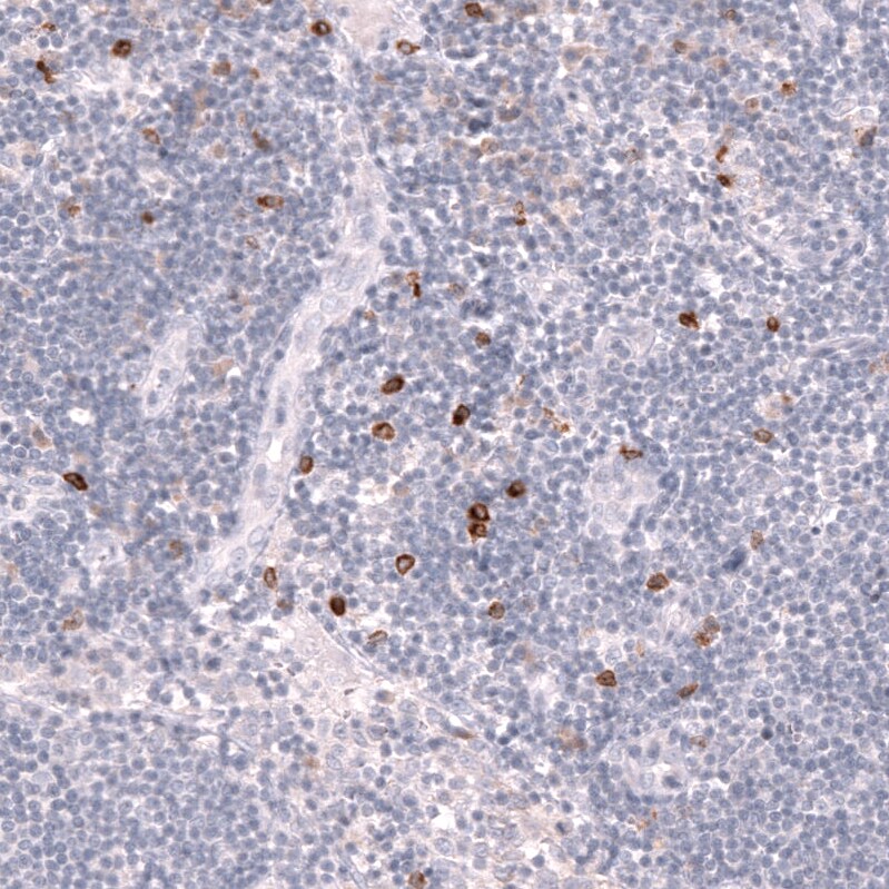 CLEC10A/CD301 Antibody (CL15523) - Azide and BSA Free Immunohistochemistry-Paraffin: CLEC10A/CD301 Antibody [NBP3-44334]