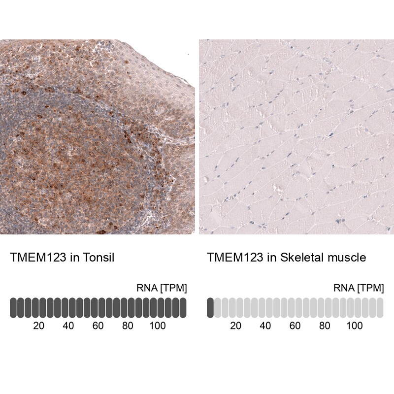 Porimin Antibody (CL14381) - Azide and BSA Free Immunohistochemistry-Paraffin: Porimin Antibody [NBP3-44335]