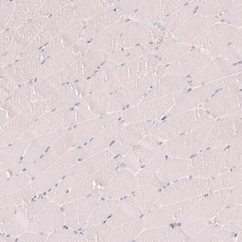 Porimin Antibody (CL14381) - Azide and BSA Free Immunohistochemistry-Paraffin: Porimin Antibody [NBP3-44335]