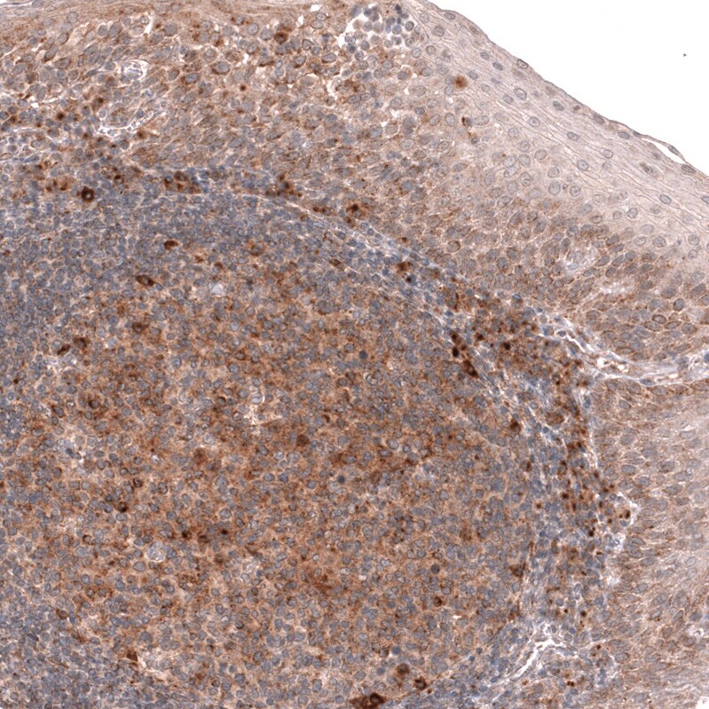 Porimin Antibody (CL14381) - Azide and BSA Free Immunohistochemistry-Paraffin: Porimin Antibody [NBP3-44335]