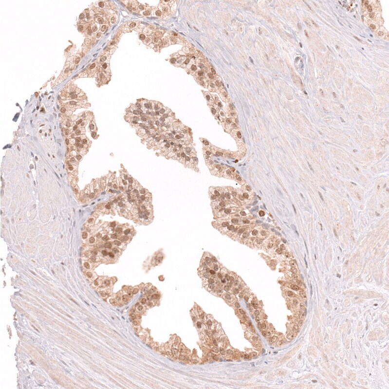 CDC2L6 Antibody (CL14116) - Azide and BSA Free Immunohistochemistry-Paraffin: CDC2L6 Antibody [NBP3-44339]