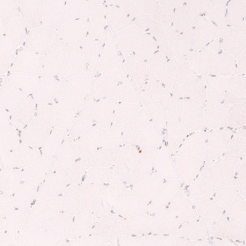 CDC2L6 Antibody (CL14116) - Azide and BSA Free Immunohistochemistry-Paraffin: CDC2L6 Antibody [NBP3-44339]