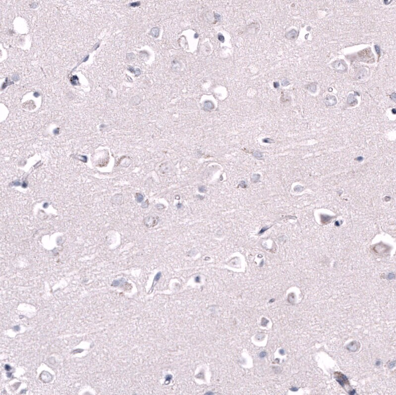 GPR88 Antibody (CL15190) - Azide and BSA Free Immunohistochemistry-Paraffin: GPR88 Antibody [NBP3-44340]