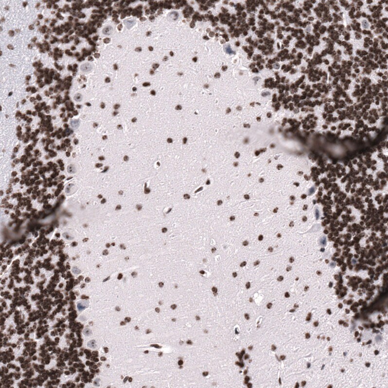 LHX9 Antibody (CL15043) - Azide and BSA Free Immunohistochemistry-Paraffin: LHX9 Antibody [NBP3-44343]