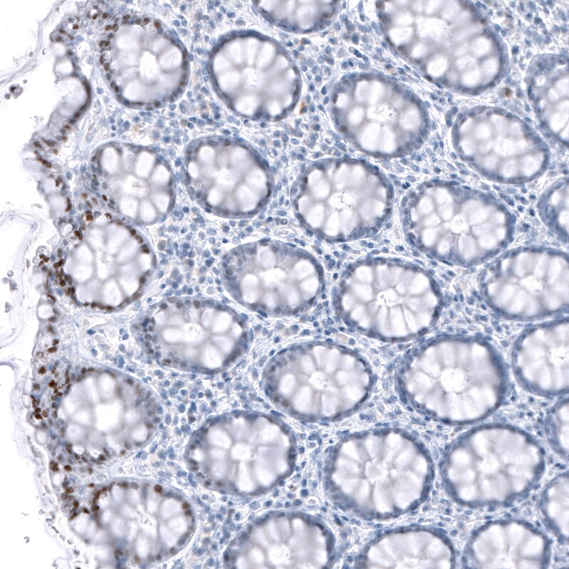 TCF7L2 Antibody (CL11547) - Azide and BSA Free Immunohistochemistry-Paraffin: TCF7L2 Antibody [NBP3-44344]