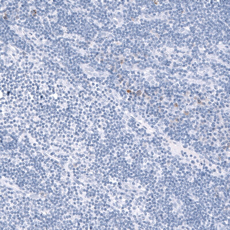 TCF7L2 Antibody (CL11547) - Azide and BSA Free Immunohistochemistry-Paraffin: TCF7L2 Antibody [NBP3-44344]