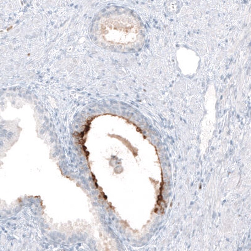 beta-1,3-Glucuronyltransferase 1/B3GAT1 Antibody (CL9500) - Azide and BSA Free Immunohistochemistry-Paraffin: beta-1,3-Glucuronyltransferase 1/B3GAT1 Antibody [NBP3-44346]