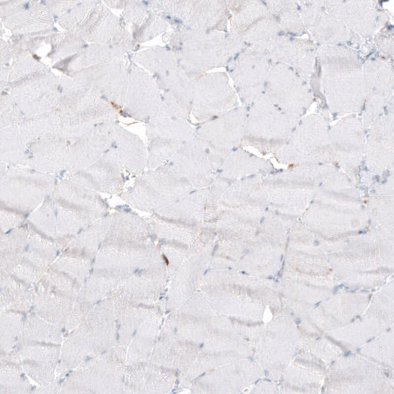 beta-1,3-Glucuronyltransferase 1/B3GAT1 Antibody (CL9500) - Azide and BSA Free Immunohistochemistry-Paraffin: beta-1,3-Glucuronyltransferase 1/B3GAT1 Antibody [NBP3-44346]