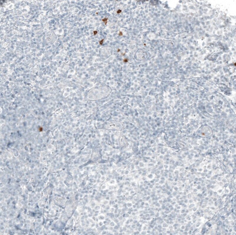 beta-1,3-Glucuronyltransferase 1/B3GAT1 Antibody (CL9500) - Azide and BSA Free Immunohistochemistry-Paraffin: beta-1,3-Glucuronyltransferase 1/B3GAT1 Antibody [NBP3-44346]