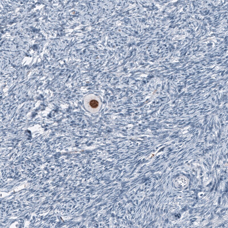 SALL4 Antibody (CL12180) - Azide and BSA Free Immunohistochemistry-Paraffin: SALL4 Antibody [NBP3-44347]
