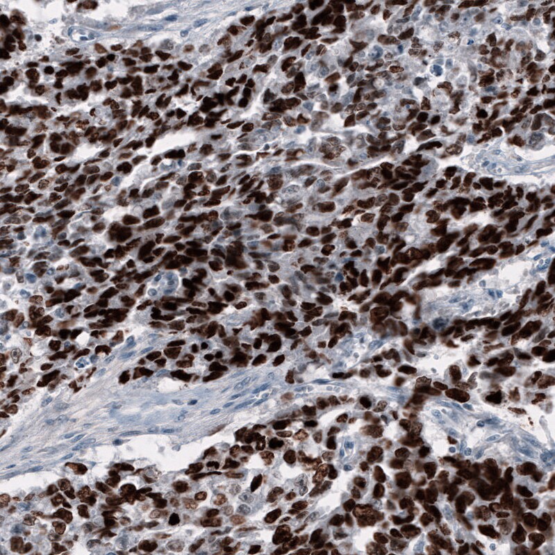 SALL4 Antibody (CL12180) - Azide and BSA Free Immunohistochemistry-Paraffin: SALL4 Antibody [NBP3-44347]