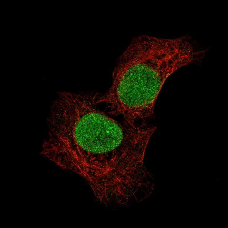 SALL4 Antibody (CL12180) - Azide and BSA Free Immunocytochemistry/ Immunofluorescence: SALL4 Antibody [NBP3-44347]