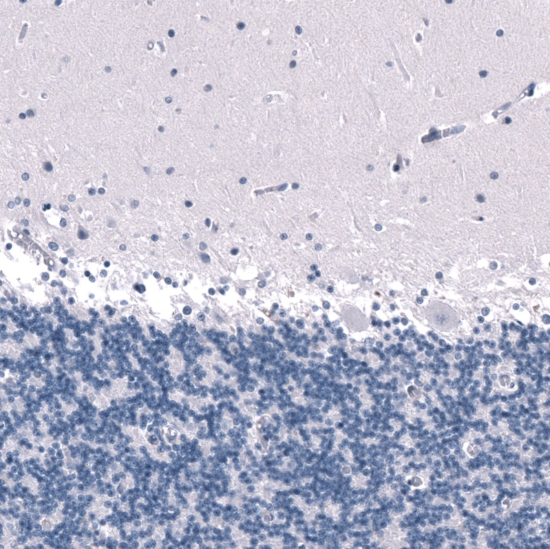 SALL4 Antibody (CL12183) - Azide and BSA Free Immunohistochemistry-Paraffin: SALL4 Antibody [NBP3-44348]