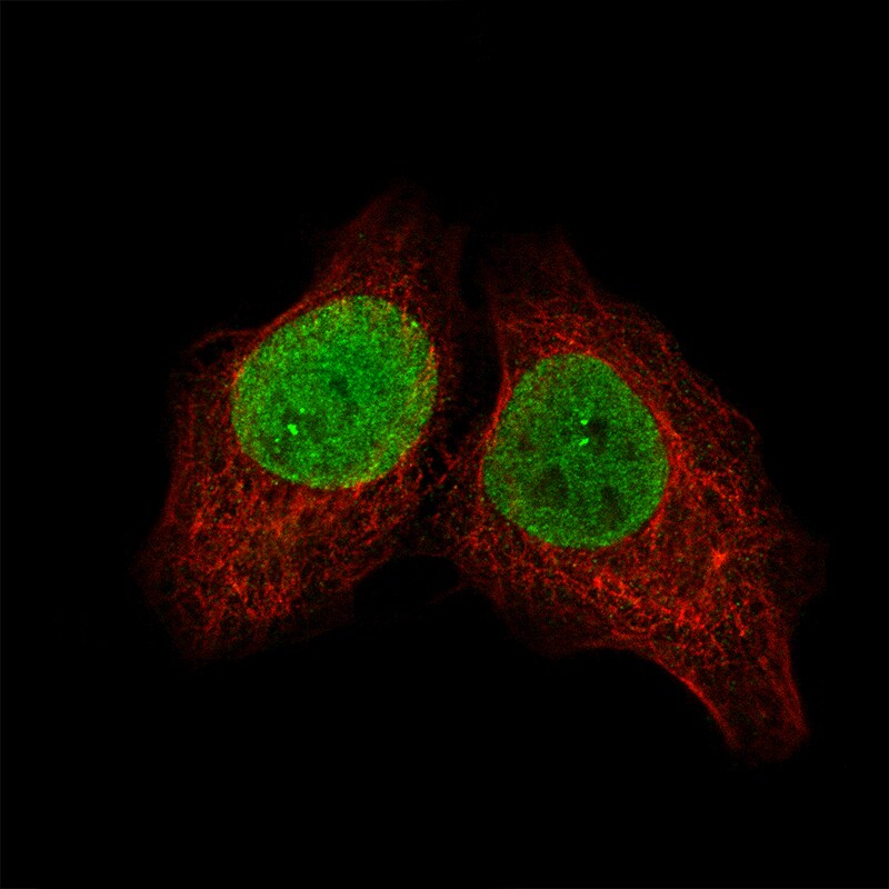 SALL4 Antibody (CL12183) - Azide and BSA Free Immunocytochemistry/ Immunofluorescence: SALL4 Antibody [NBP3-44348]