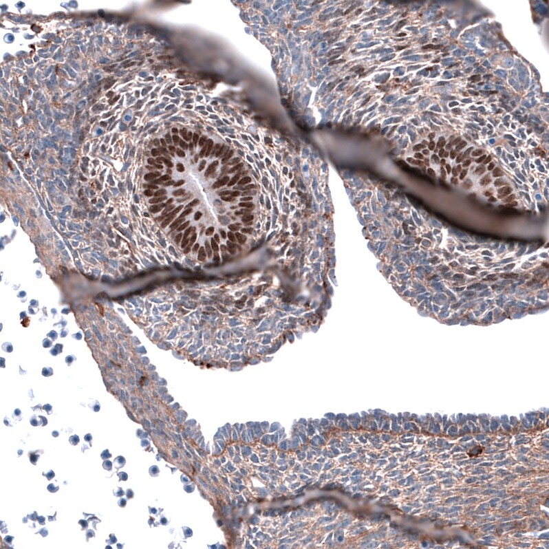 SALL4 Antibody (CL12183) - Azide and BSA Free Immunohistochemistry-Paraffin: SALL4 Antibody [NBP3-44348]