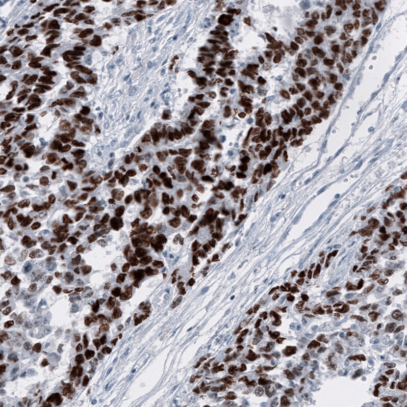 SALL4 Antibody (CL12183) - Azide and BSA Free Immunohistochemistry-Paraffin: SALL4 Antibody [NBP3-44348]
