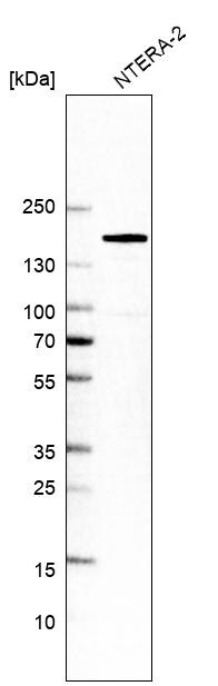 SALL4 Antibody (CL12183) - Azide and BSA Free Western Blot: SALL4 Antibody [NBP3-44348]