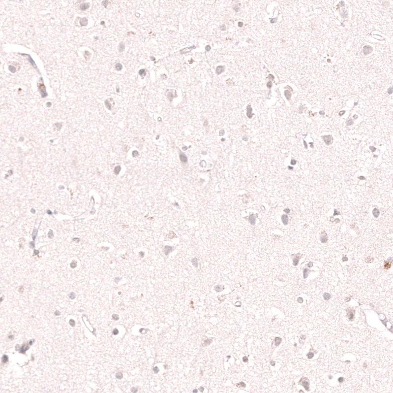 KLF2 Antibody (CL14502) - Azide and BSA Free Immunohistochemistry-Paraffin: KLF2 Antibody [NBP3-44350]