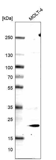 ICOS Antibody (CL14825) - Azide and BSA Free Western Blot: ICOS Antibody [NBP3-44351]