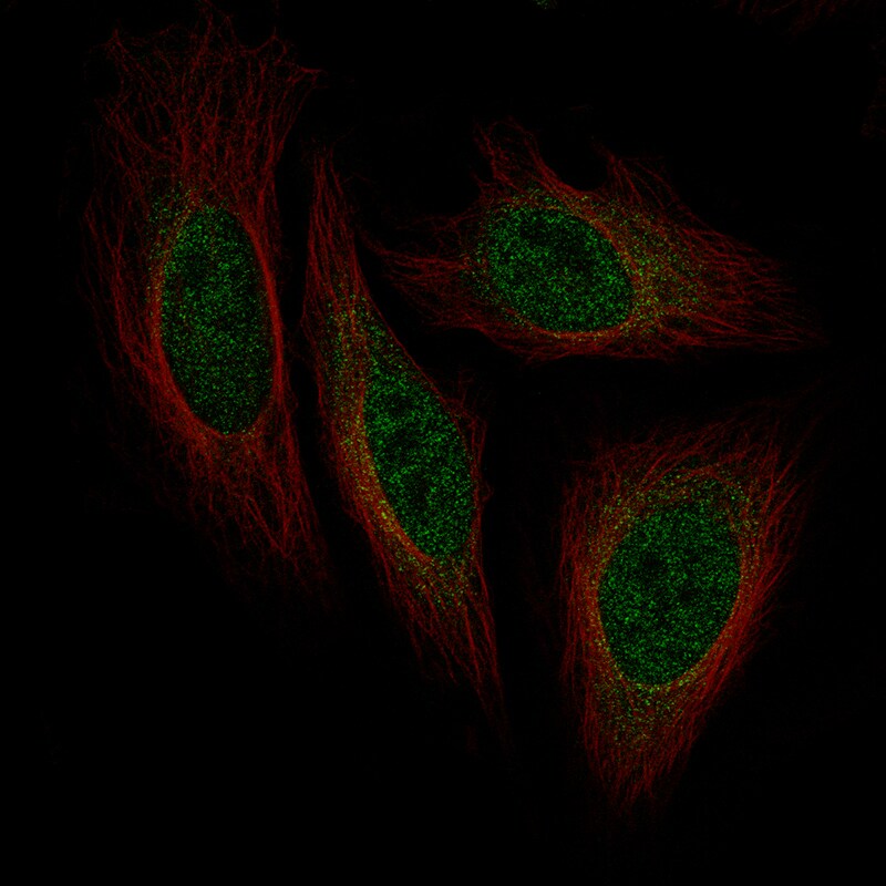 Islet-1 Antibody (CL11651) - Azide and BSA Free Immunocytochemistry/ Immunofluorescence: Islet-1 Antibody [NBP3-44352]