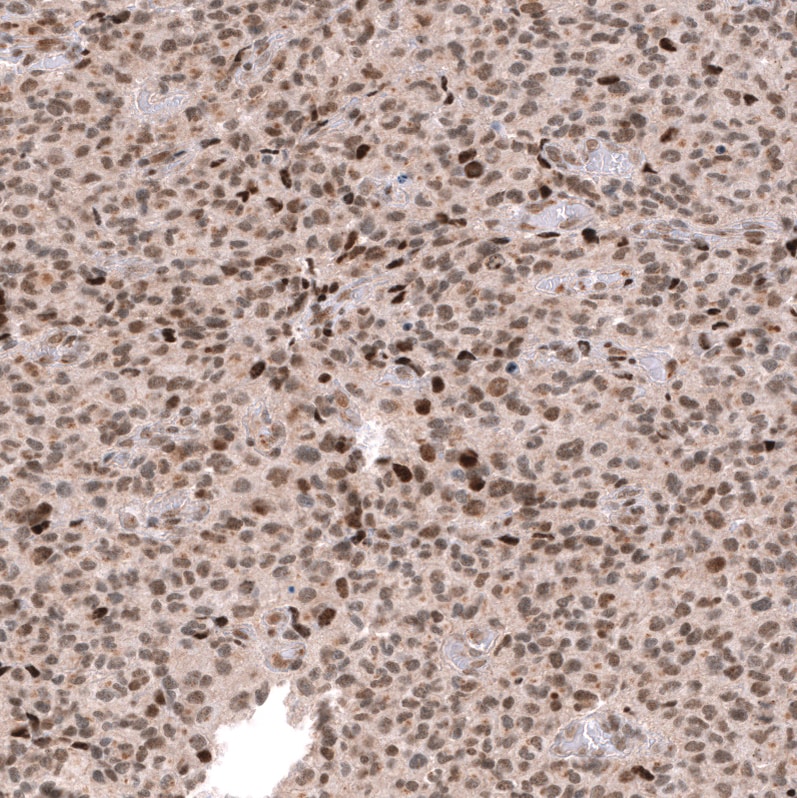 EZH2/KMT6 Antibody (CL11960) - Azide and BSA Free Immunohistochemistry-Paraffin: EZH2/KMT6 Antibody [NBP3-44355]