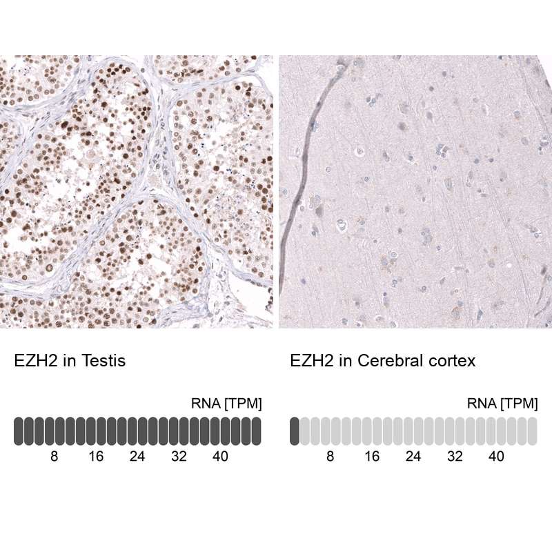 EZH2/KMT6 Antibody (CL11960) - Azide and BSA Free Immunohistochemistry-Paraffin: EZH2/KMT6 Antibody [NBP3-44355]