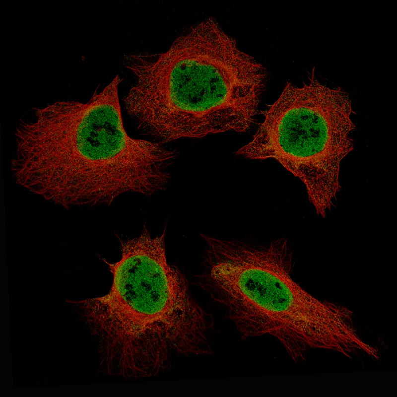 EZH2/KMT6 Antibody (CL11960) - Azide and BSA Free Immunocytochemistry/ Immunofluorescence: EZH2/KMT6 Antibody [NBP3-44355]