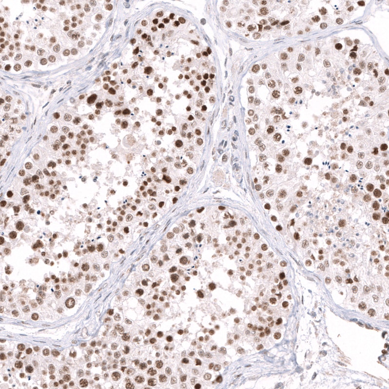 EZH2/KMT6 Antibody (CL11960) - Azide and BSA Free Immunohistochemistry-Paraffin: EZH2/KMT6 Antibody [NBP3-44355]