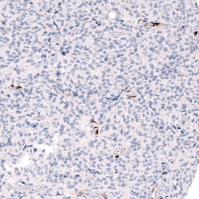 ALDH1A3 Antibody (CL11968) - Azide and BSA Free Immunohistochemistry-Paraffin: ALDH1A3 Antibody [NBP3-44356]