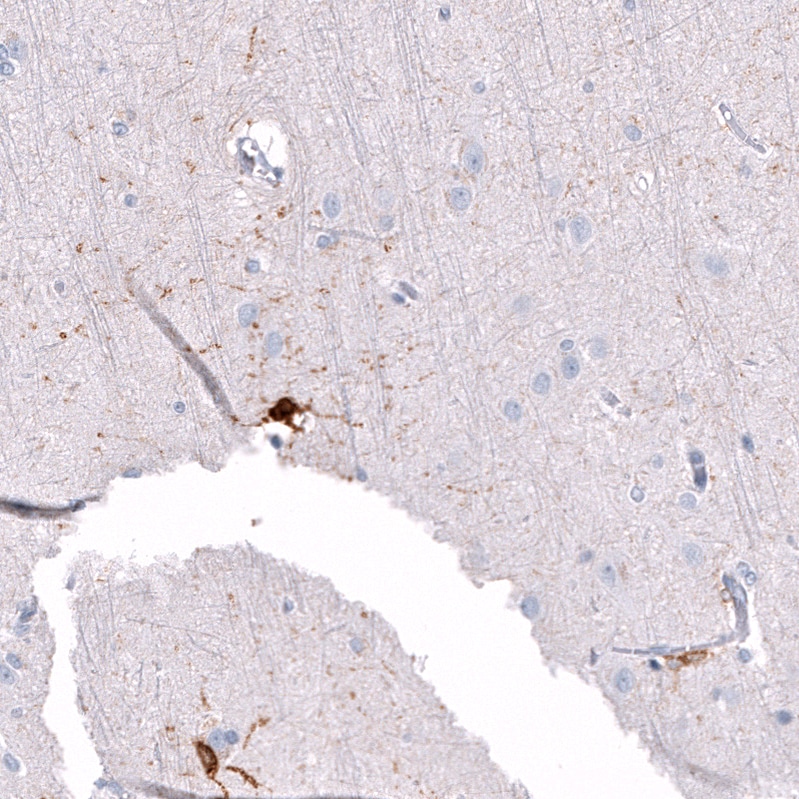 ALDH1A3 Antibody (CL11968) - Azide and BSA Free Immunohistochemistry-Paraffin: ALDH1A3 Antibody [NBP3-44356]