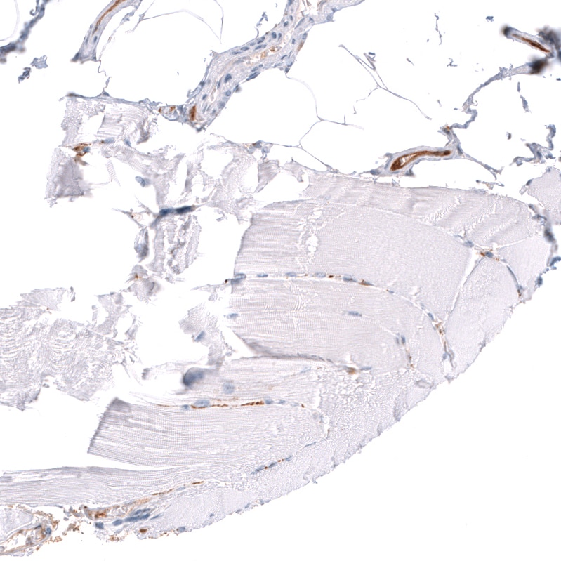 ALDH1A3 Antibody (CL11968) - Azide and BSA Free Immunohistochemistry-Paraffin: ALDH1A3 Antibody [NBP3-44356]