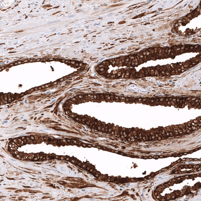 ALDH1A3 Antibody (CL11968) - Azide and BSA Free Immunohistochemistry-Paraffin: ALDH1A3 Antibody [NBP3-44356]