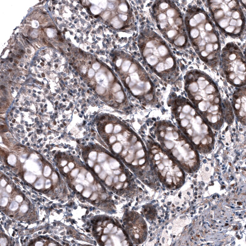 ID1 Antibody (CL11995) - Azide and BSA Free Immunohistochemistry-Paraffin: ID1 Antibody [NBP3-44357]