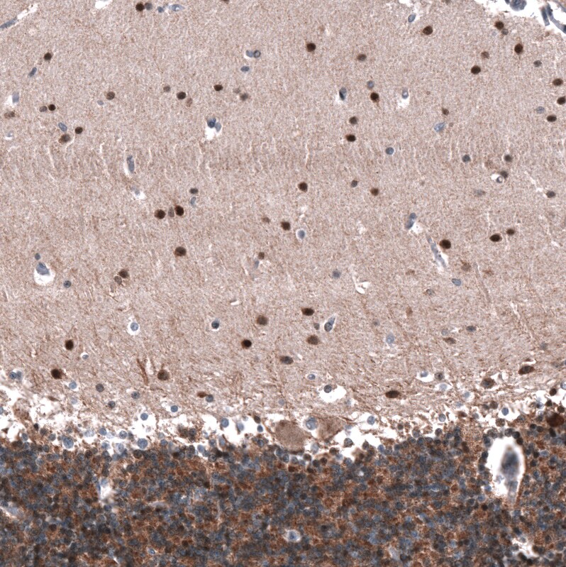 ID1 Antibody (CL11995) - Azide and BSA Free Immunohistochemistry-Paraffin: ID1 Antibody [NBP3-44357]