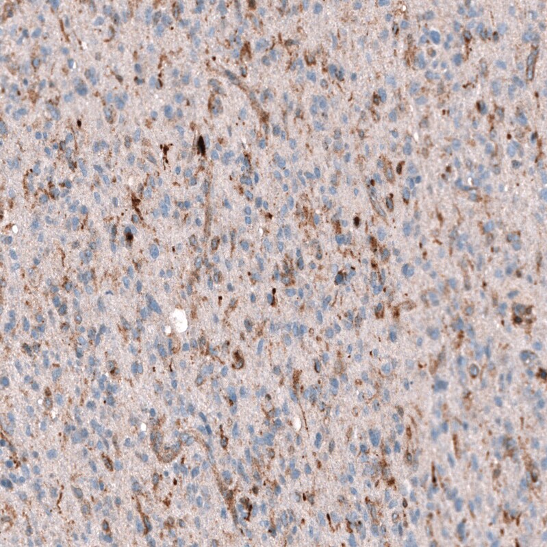 Periostin/OSF-2 Antibody (CL12087) - Azide and BSA Free Immunohistochemistry-Paraffin: Periostin/OSF-2 Antibody [NBP3-44358]