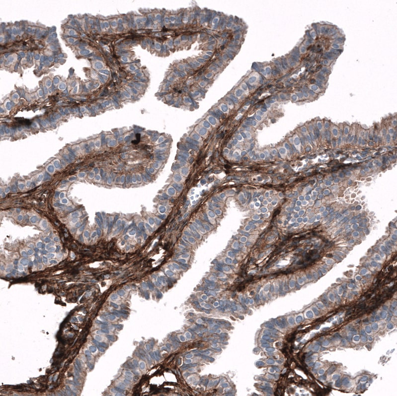 Periostin/OSF-2 Antibody (CL12087) - Azide and BSA Free Immunohistochemistry-Paraffin: Periostin/OSF-2 Antibody [NBP3-44358]