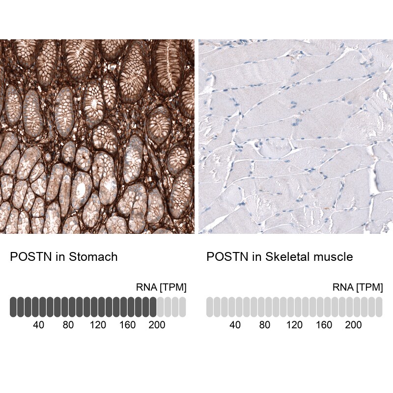 Periostin/OSF-2 Antibody (CL12087) - Azide and BSA Free Immunohistochemistry-Paraffin: Periostin/OSF-2 Antibody [NBP3-44358]