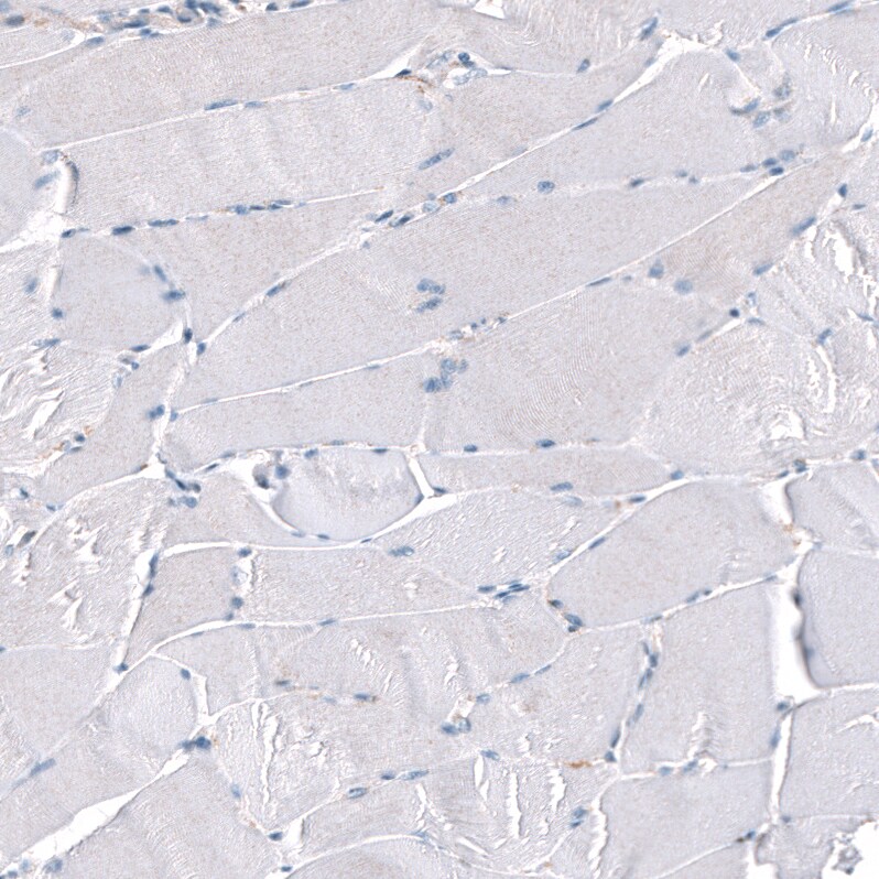 Periostin/OSF-2 Antibody (CL12087) - Azide and BSA Free Immunohistochemistry-Paraffin: Periostin/OSF-2 Antibody [NBP3-44358]