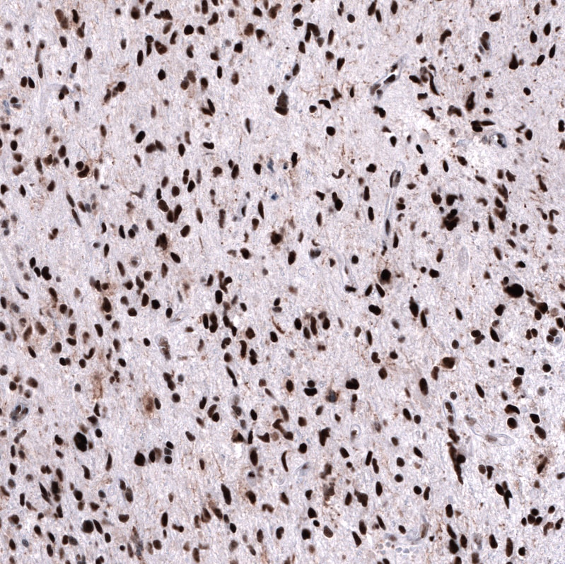 FoxM1 Antibody (CL12131) - Azide and BSA Free Immunohistochemistry-Paraffin: FoxM1 Antibody [NBP3-44359]