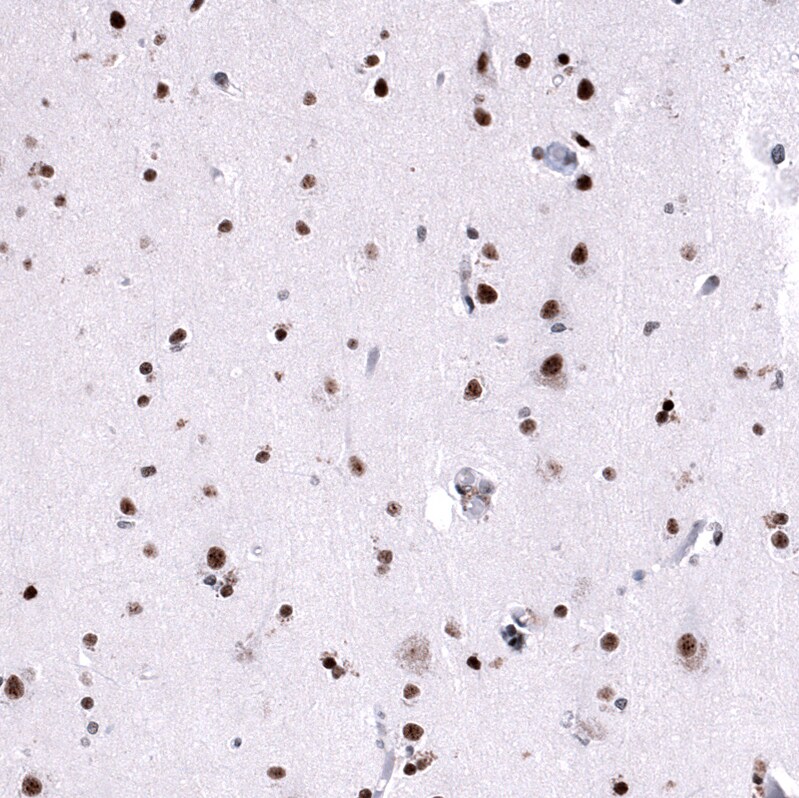 FoxM1 Antibody (CL12131) - Azide and BSA Free Immunohistochemistry-Paraffin: FoxM1 Antibody [NBP3-44359]