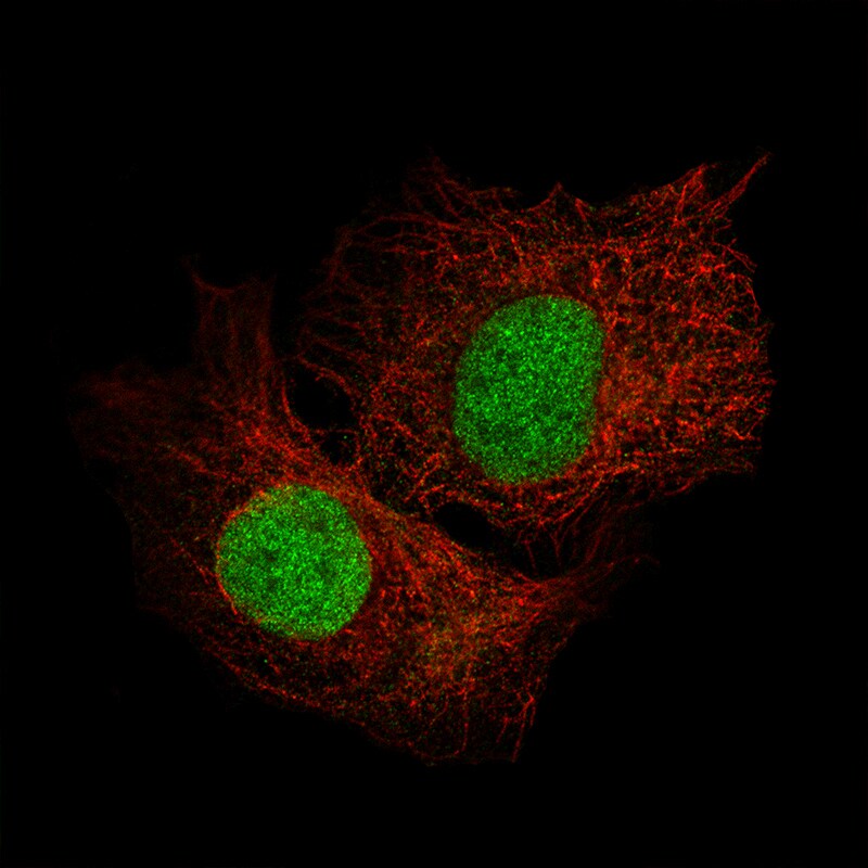 SALL4 Antibody (CL12185) - Azide and BSA Free Immunocytochemistry/ Immunofluorescence: SALL4 Antibody [NBP3-44360]