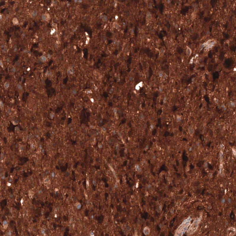 Chitinase 3-like 1/YKL-40 Antibody (CL12314) - Azide and BSA Free Immunohistochemistry-Paraffin: Chitinase 3-like 1/YKL-40 Antibody [NBP3-44361]