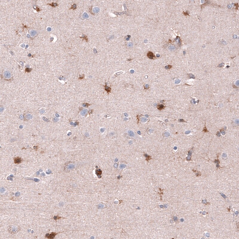 Chitinase 3-like 1/YKL-40 Antibody (CL12314) - Azide and BSA Free Immunohistochemistry-Paraffin: Chitinase 3-like 1/YKL-40 Antibody [NBP3-44361]