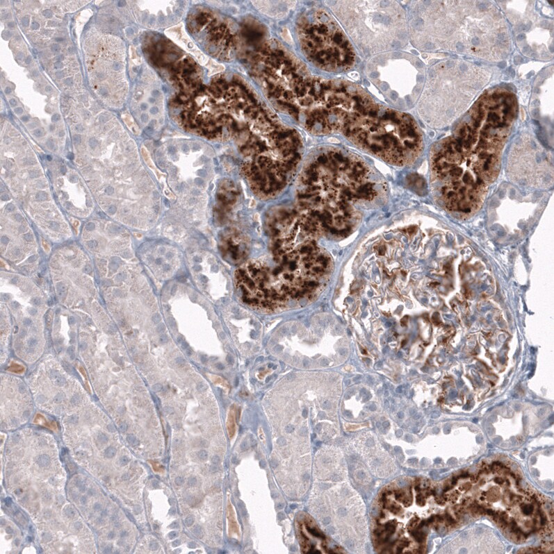 Chitinase 3-like 1/YKL-40 Antibody (CL12314) - Azide and BSA Free Immunohistochemistry-Paraffin: Chitinase 3-like 1/YKL-40 Antibody [NBP3-44361]