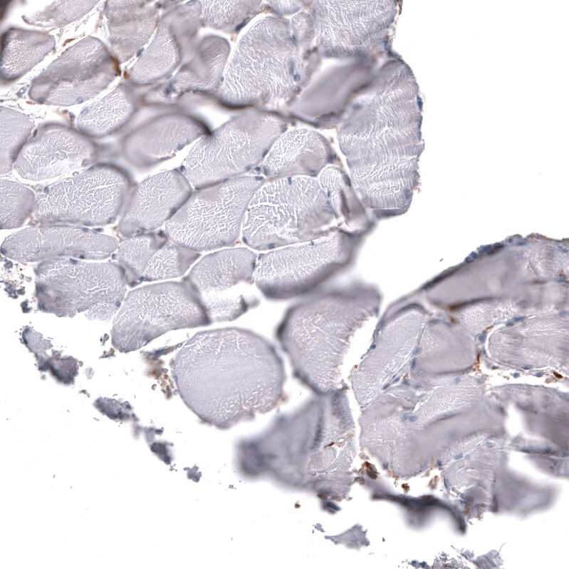 Chitinase 3-like 1/YKL-40 Antibody (CL12314) - Azide and BSA Free Immunohistochemistry-Paraffin: Chitinase 3-like 1/YKL-40 Antibody [NBP3-44361]