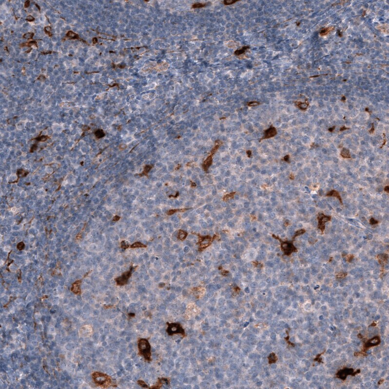 Chitinase 3-like 1/YKL-40 Antibody (CL12314) - Azide and BSA Free Immunohistochemistry-Paraffin: Chitinase 3-like 1/YKL-40 Antibody [NBP3-44361]