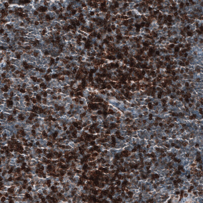 CD5 Antibody (CL12334) - Azide and BSA Free Immunohistochemistry-Paraffin: CD5 Antibody [NBP3-44362]